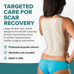 The EpiDerm large silicone sheet can be cut to fit scar shapes.