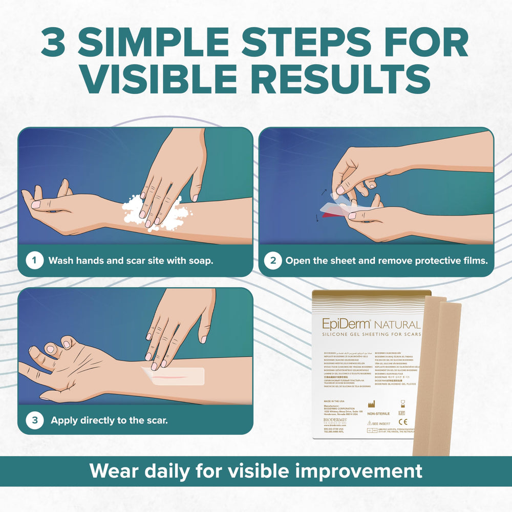 EpiDerm Long Strips air drying after cleaning for reuse
