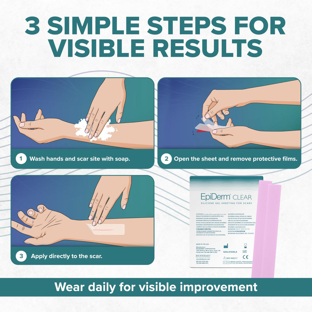 BIODERMIS elastic, flexible scar tape moves with you during daily activities.