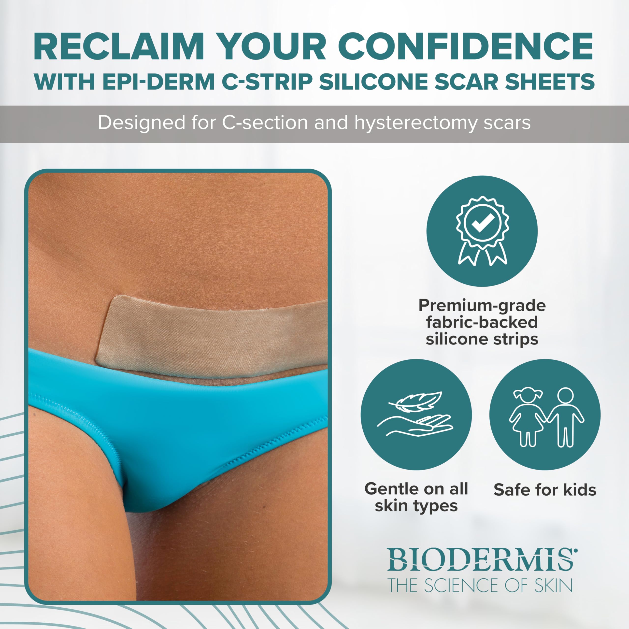 EpiDerm silicone sheets contour to the body for comfortable scar care
