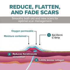 Easy-Grip liner helps precise placement and quick application of EpiDerm sheets