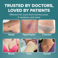 Five-pack Biodermis EpiDerm sheets support versatile scar management