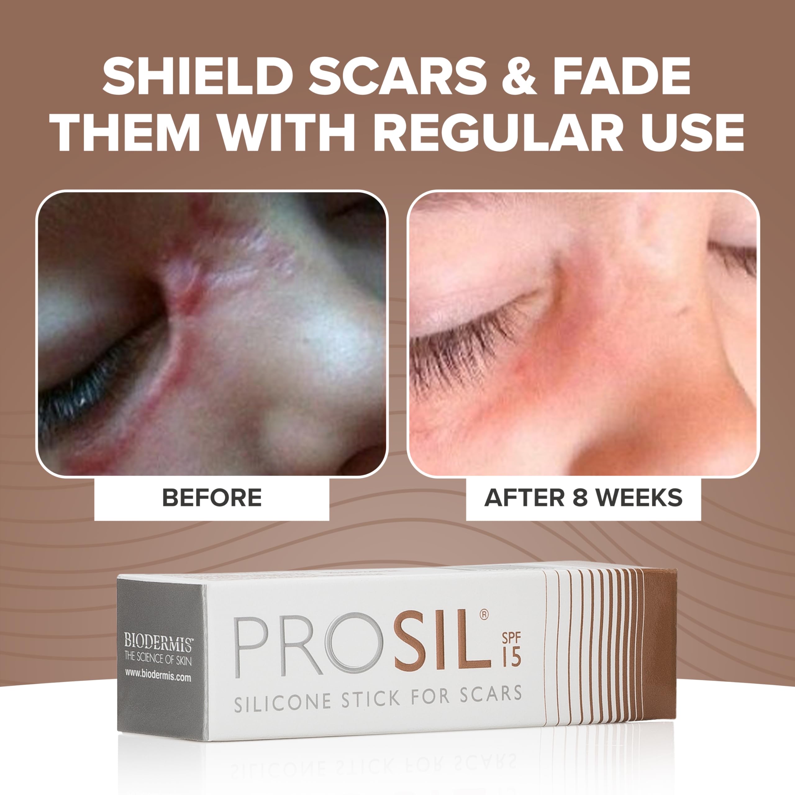 BIODERMIS ProSil compact travel size fits in pockets for on-the-go scar care.