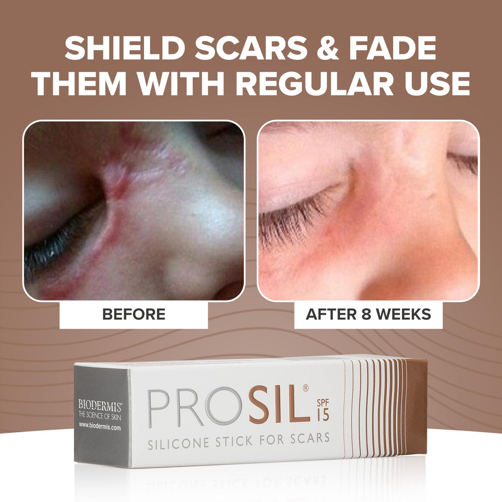 BIODERMIS ProSil compact travel size fits in pockets for on-the-go scar care.