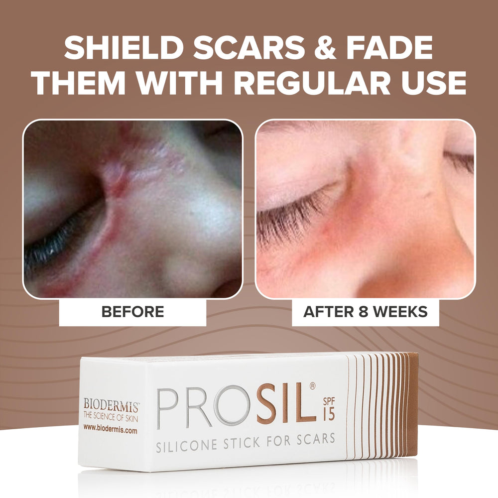 BIODERMIS ProSil travel-compact stick for on-the-go use