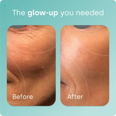 Biosil Collagen Booster packaging 2-pack highlights value and ongoing routine