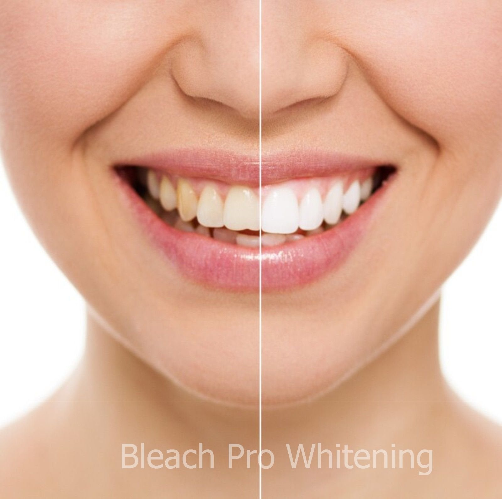 Bleach Pro Whitening box with branding for easy storage