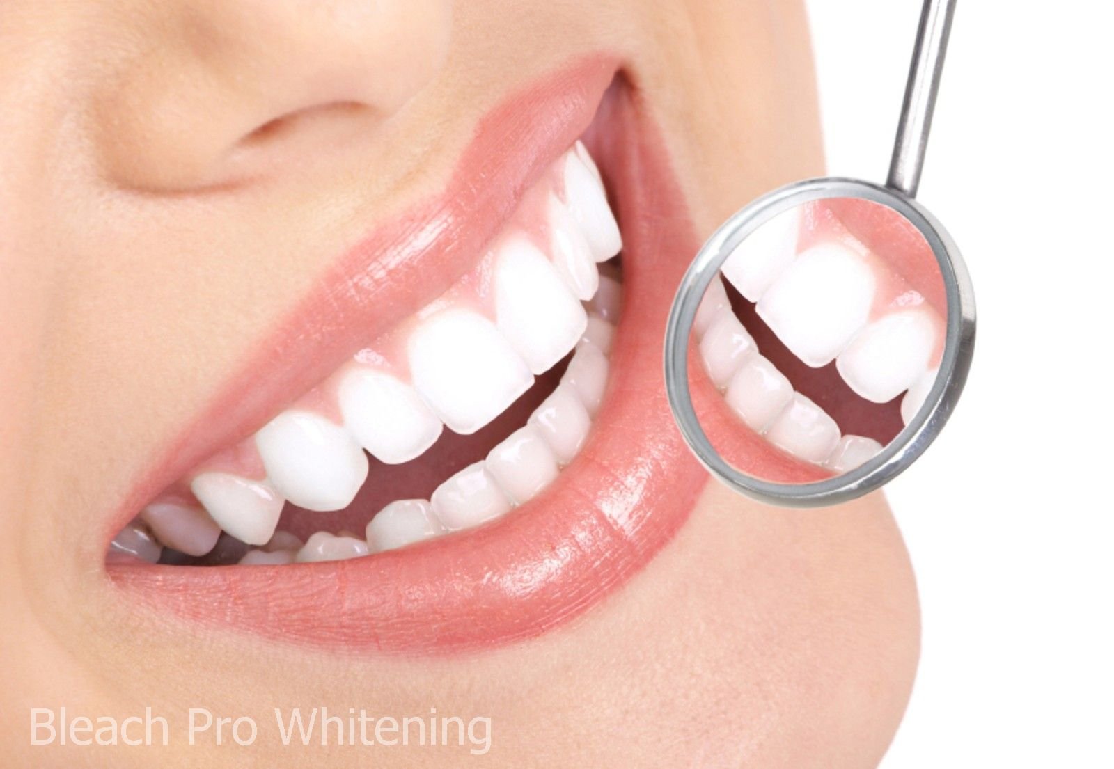 Smiling face after using Bleach Pro whitening gel