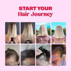 Bloom Robbins Hair Gummy label emphasizing purity and allergen‑free formulation