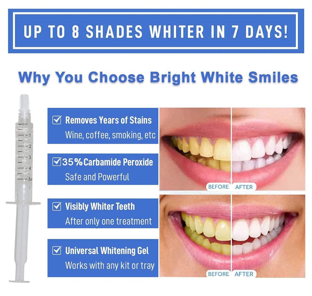 Bright White Smiles stain removal on coffee and tea marks.