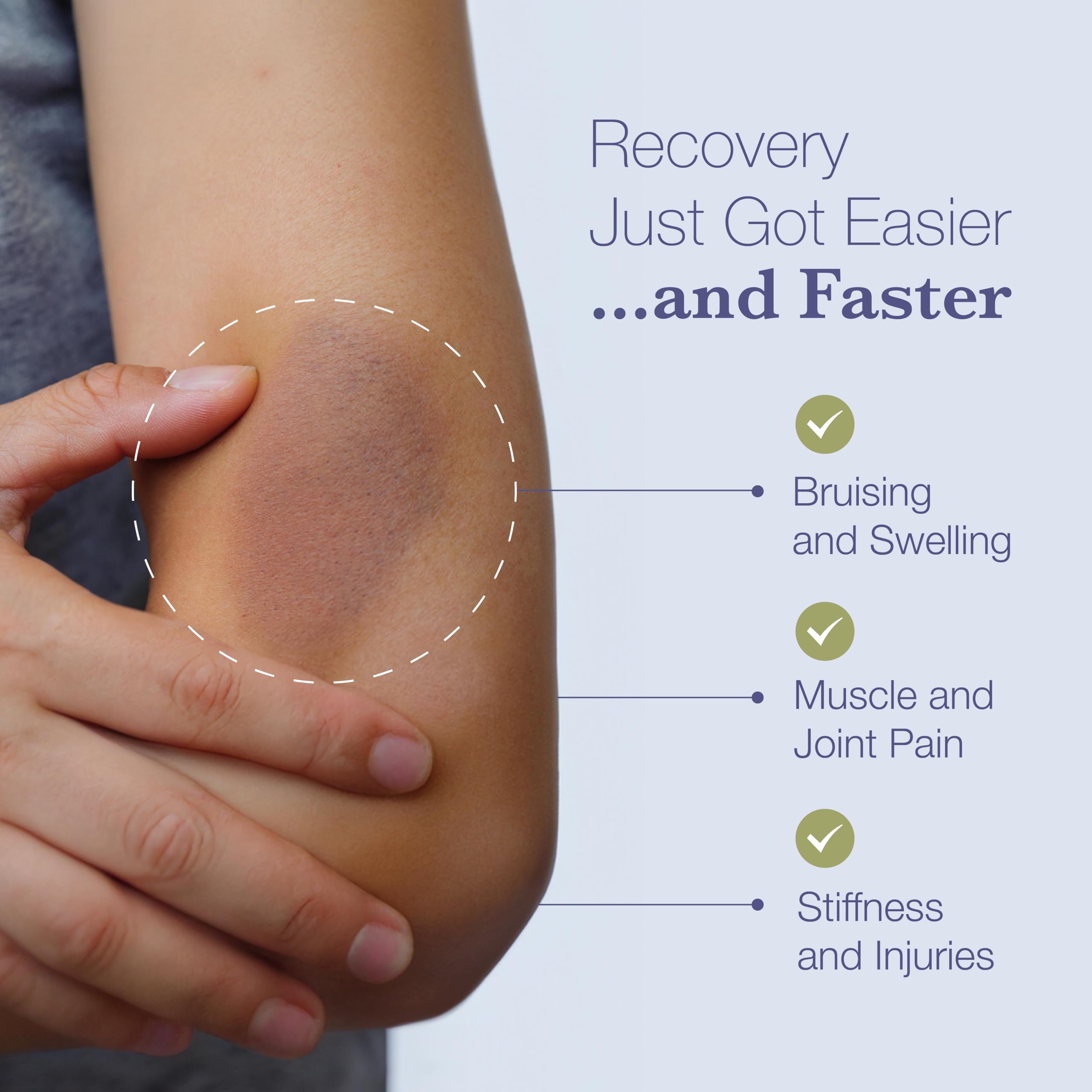 BruiseMD caffeine and bromelain image demonstrates soothing topical application