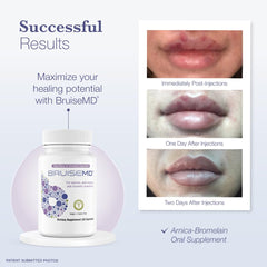 Easy-to-swallow capsules illustrated for convenient daily use.