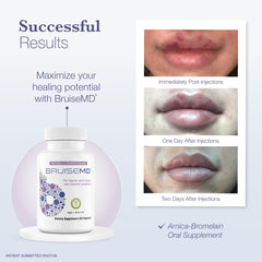 USA-made BruiseMD label indicating vegan, GMP-certified formulation