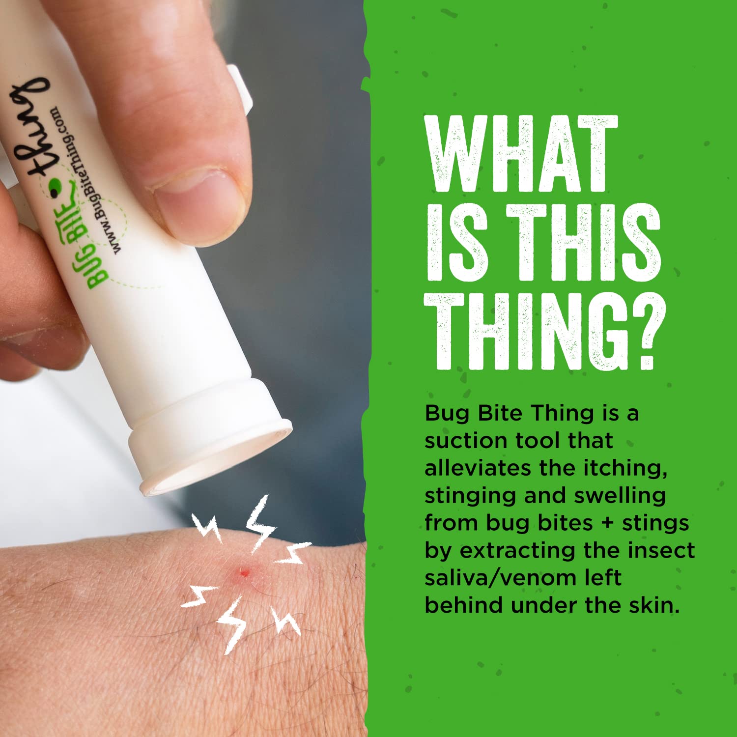 BUG BITE THING pink suction tool in use alleviating itching and swelling from stings.