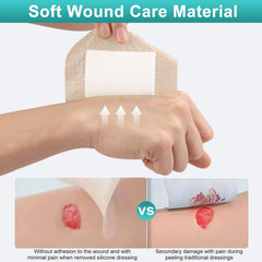 CAKRNPS silicone foam dressing water resistant film seals moisture