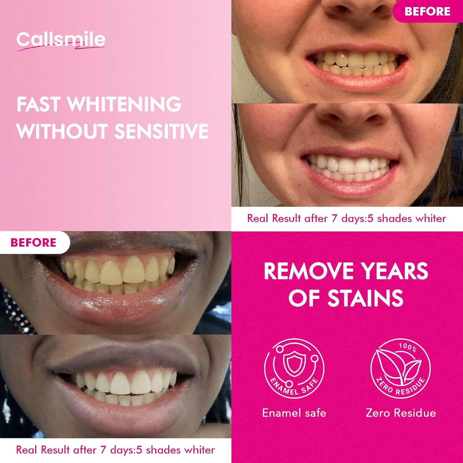 Callsmile strip-on-teeth close-up showing thin, gentle whitening.