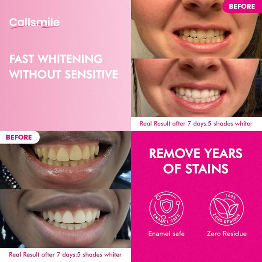 Callsmile strip-on-teeth close-up showing thin, gentle whitening.