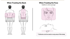 Celluma PRO LED panel wrapped around an arm for hands-free therapy.