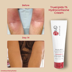Cream texture moisturizes cracked skin and supports barrier