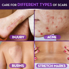 Face skin after Cicatricure application shows improved smoothness.
