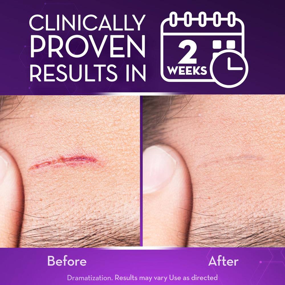 Cicatricure scar gel smooths and hydrates scar tissue