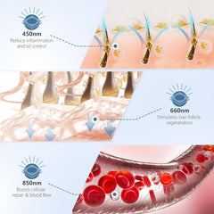 Detachable patch on Cilate cap enables customizable light therapy sessions.
