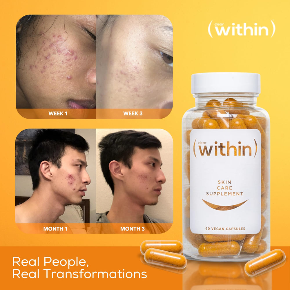 Clear Within skincare routine close-up signals easy daily use.