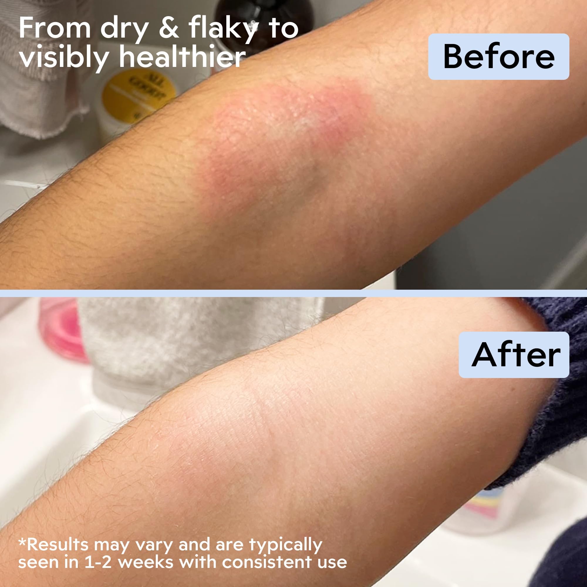 Winter hands application with Clearbody Organics Manuka Honey Cream