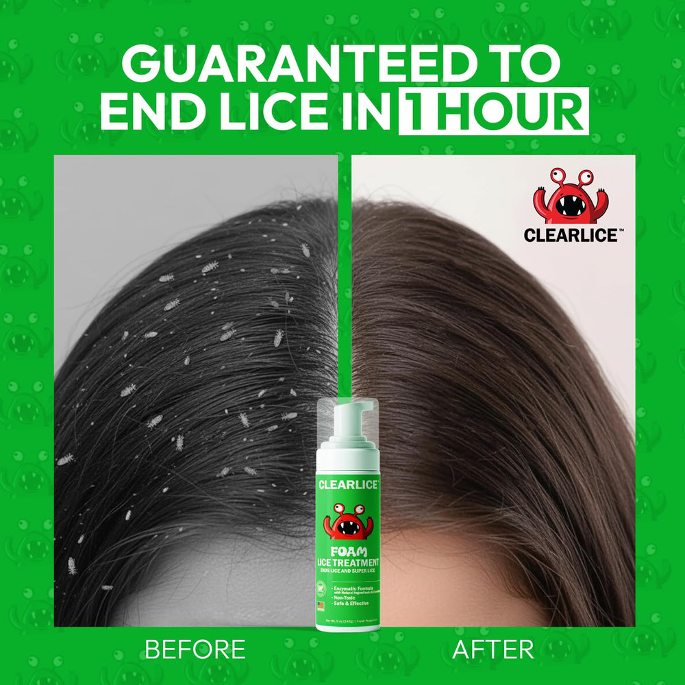 Clearlice foam close-up showing natural formula for family use