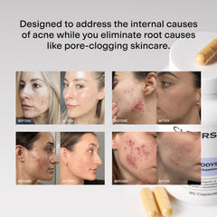 CLEARSTEM Mindbodyskin packaging ready for daily use and routine.