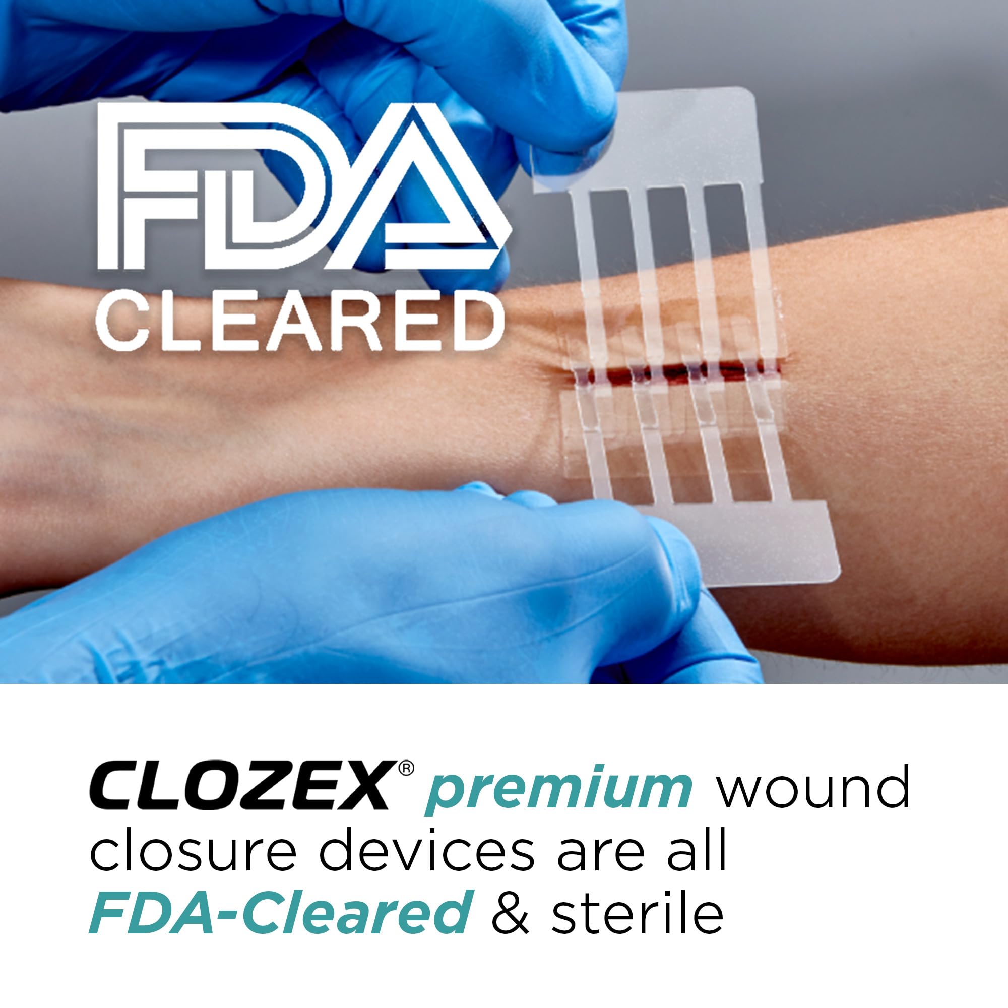 Clozex child wound close-up shows skin-friendly adhesion without piercing