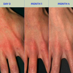 Codex Labs BIA Eczema Relief Lotion close-up shows soothing hydration for eczema-prone skin