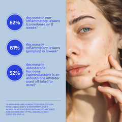 Codex Labs Shaant Skin De-Stress bottle pour image illustrating easy dosage.