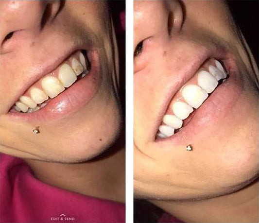COLO Color Wheel Teeth Whitener Mint gel swirl used in quick at-home whitening sessions