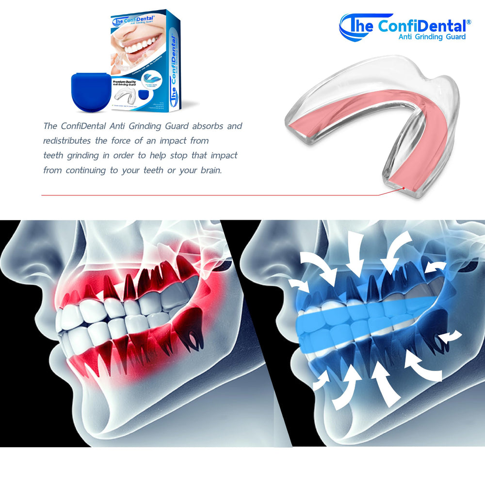ConfiDental boil-and-bite setup enables at-home molding for a custom feel.