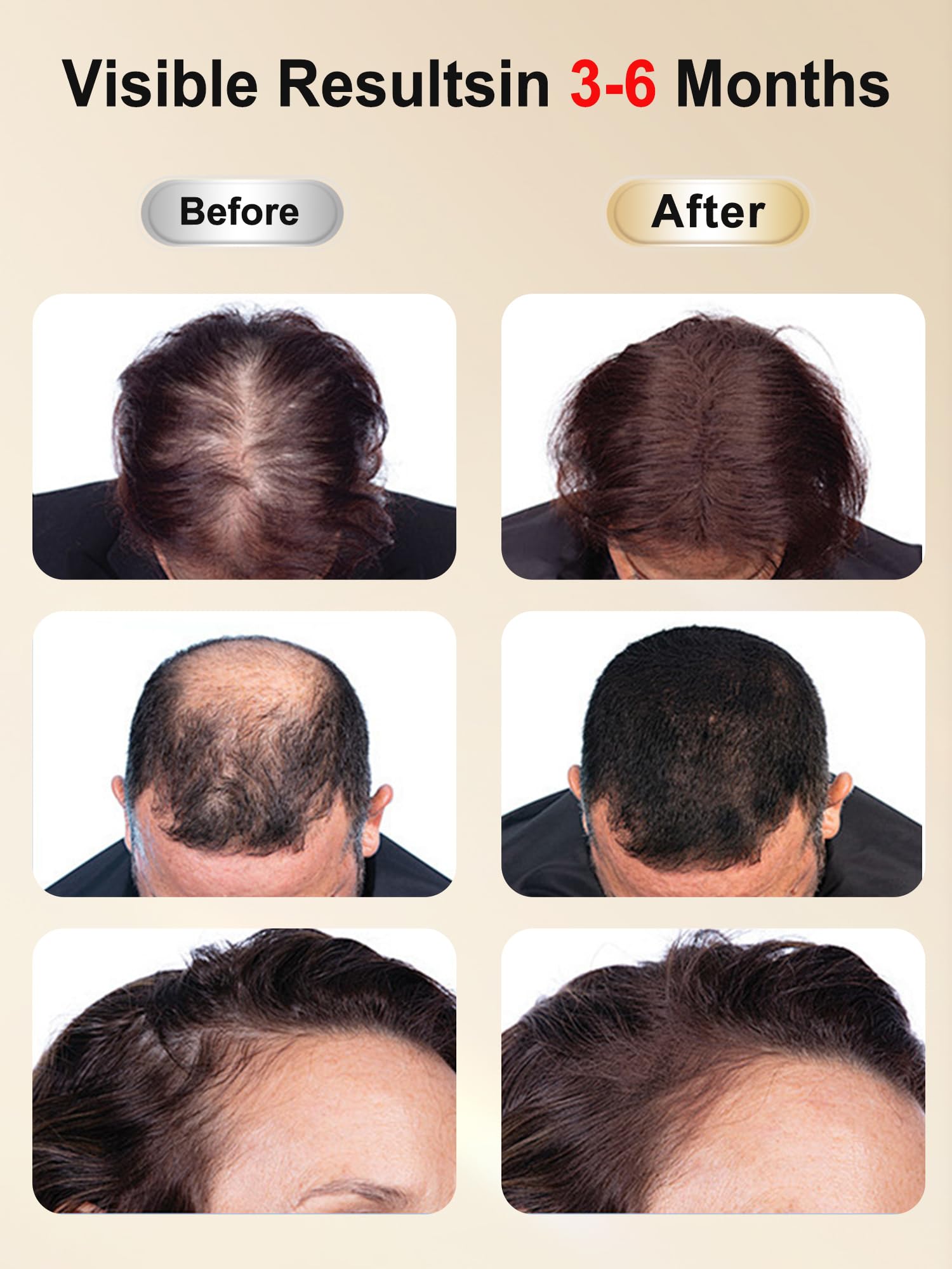 DAWNBOX 850nm infrared light close-up penetrates scalp layers