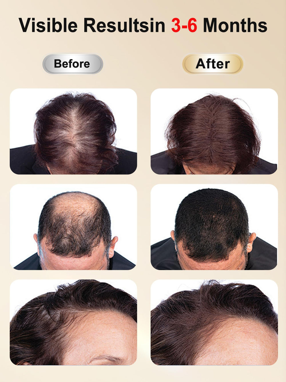 DAWNBOX 850nm infrared light close-up penetrates scalp layers