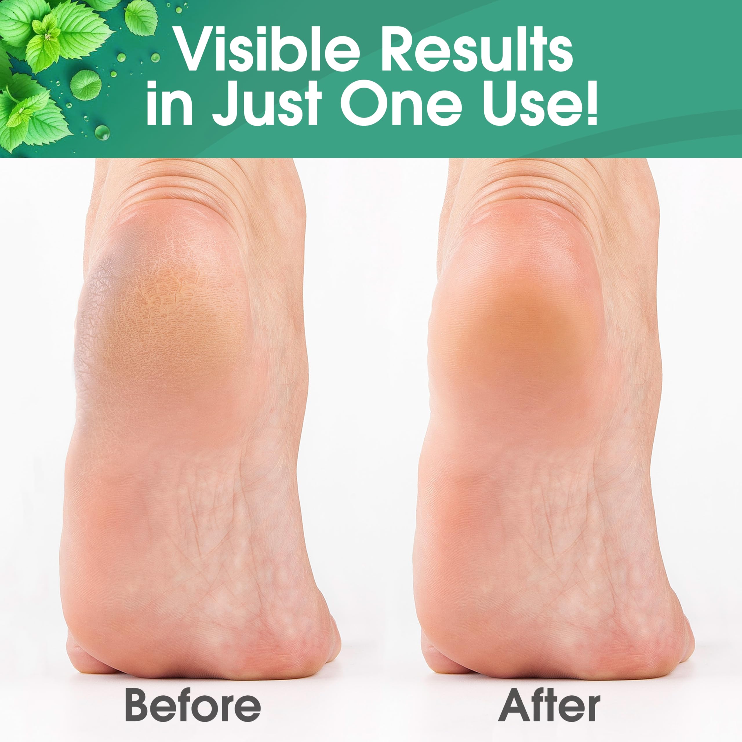 DeEnti Callus Remover bulk packaging emphasizes salon-grade bulk supplies for professionals.