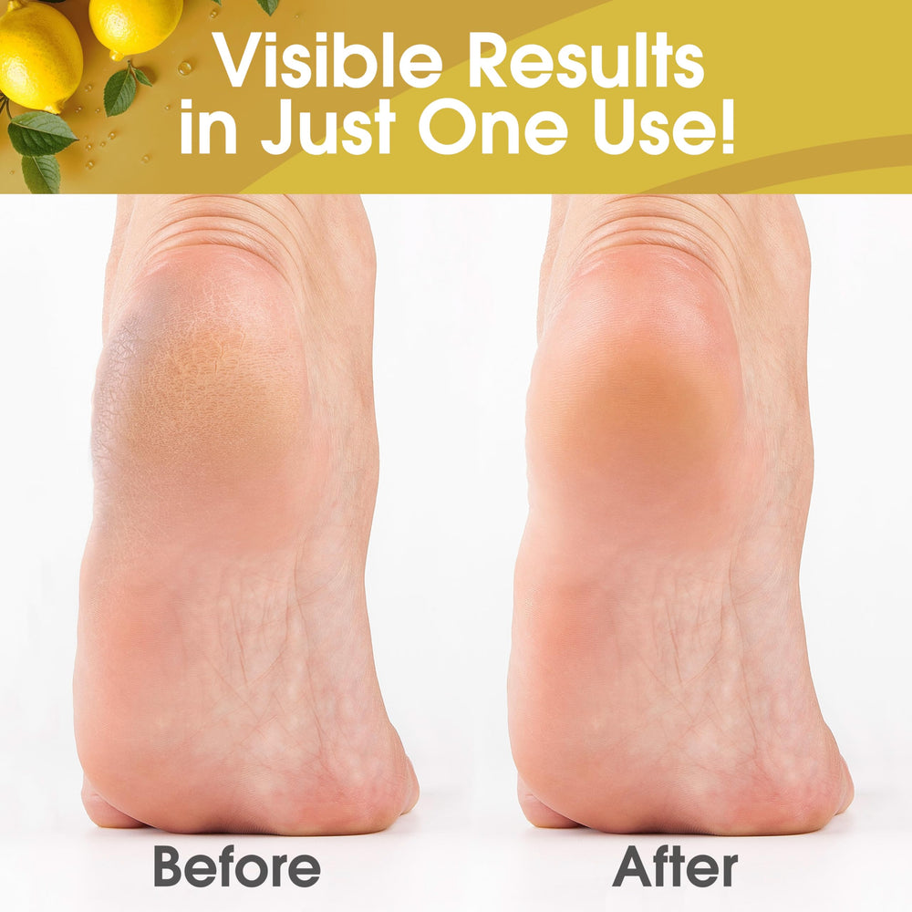 Home pedicure setup with DeEnti foot care for dry skin.