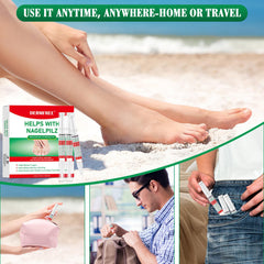 DERMFREE Toe Nail Fungus Renewal Pen after-use shot suggests improved nail appearance.