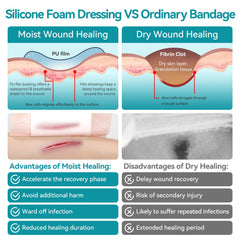 Dimora border-coverage close-up highlighting secure protection over leg ulcers.