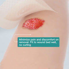 Dimora silicone wound contact layer closeup shows skin-friendly, non-stick contact.