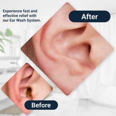 Doctor Easy Wax-Rx three-washes pack for multiple uses.