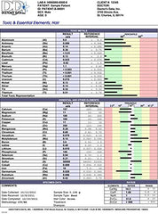 Doctors Data Essential Elements hair test kit reveals mineral balance insights for health.