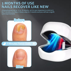 Easheal nail fungus laser device compact design fits neatly on a vanity