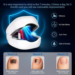 Easheal nail fungus laser device in use demonstrates at-home therapy session