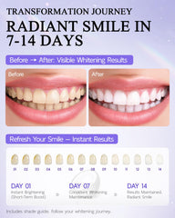 Easyes coconut oil and niacinamide enamel protection within the strips