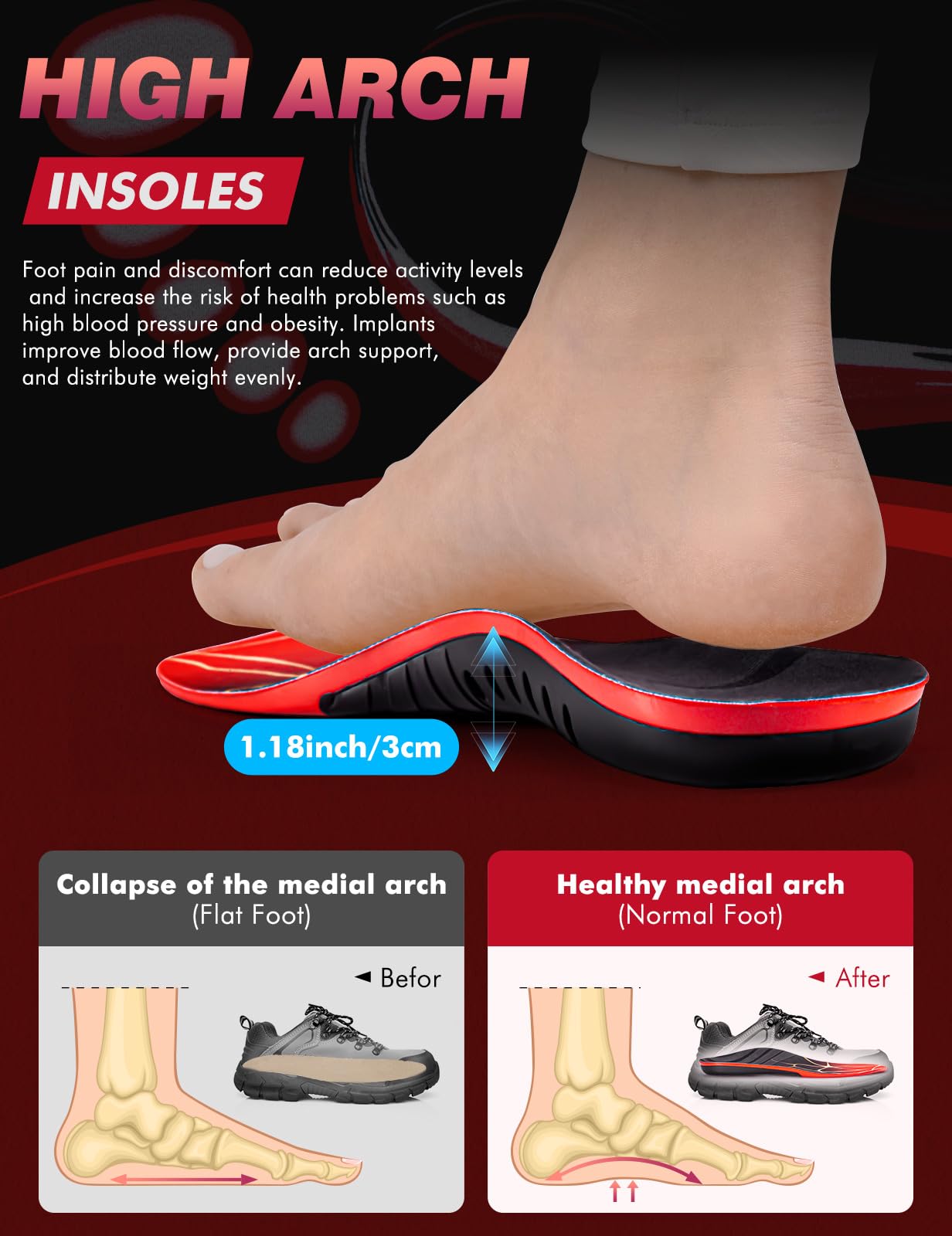 EIRMAT arch-support core TPU provides sturdy lift for all-day stability.