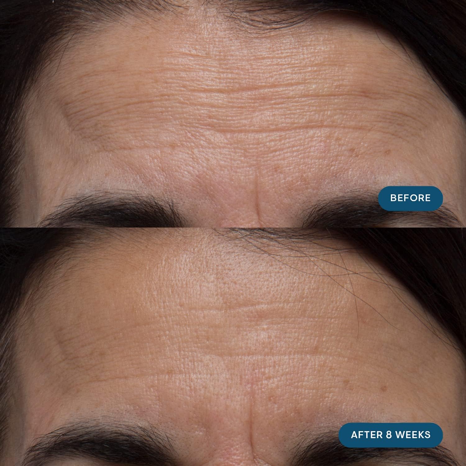 Elemis Pro-Collagen capsules ready for daily consumption.