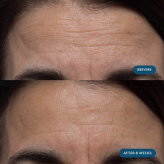 Elemis Pro-Collagen capsules ready for daily consumption.